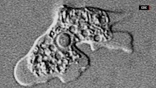 How dangerous are brain eating amoeba [upl. by Noam306]