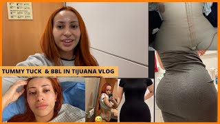 I WENT TO TIJUANA ALONE FOR TUMMY TUCK amp BBL VLOG  DR PUEBLA [upl. by Sirret744]