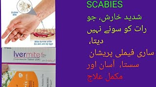 scabies khujli ka ilaj skin elarji ka ilaj harish ka ilaj shahhussain6718 oladoc [upl. by Wiltshire]