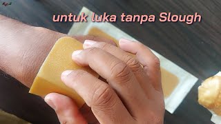 DuoDerm Extra Thin Apakah Bisa Untuk Luka Ca mamae  RaFer QnA [upl. by Anirav]