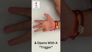 Unusual Case Of Trigger Finger In A Child [upl. by Idnem]