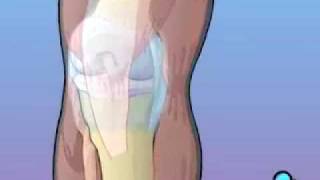 PreOp® Anterior Cruciate Ligament Patient Education [upl. by Osnerol23]