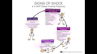 Progressive stage of shock Physiology [upl. by Weixel]