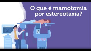 Mamotomia por estereotaxia Você sabe para quê é esse exame [upl. by Anaihsat767]