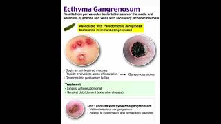 Ecthyma gangrenosum [upl. by Beebe]