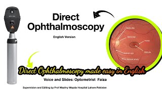 Direct Ophthalmoscopy technique made easyEnglish1 [upl. by Kronfeld]