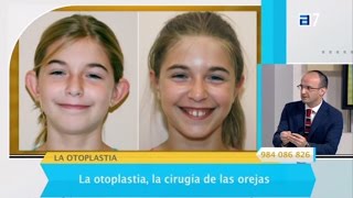 Los doctores Fernández hablan sobre la otoplastia en TPA [upl. by Annaear89]