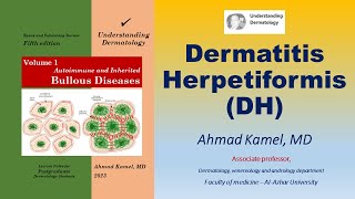 Dermatitis Herpetiformis DH [upl. by Herbie11]