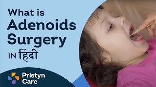 What is Adenoids Surgery in hindi [upl. by Valaria]