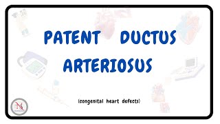 PATENT DUCTUS ARTERIOSUS  Causes  Symptoms  Pathophysiology  Treatment  The Nurses Station [upl. by Aital248]