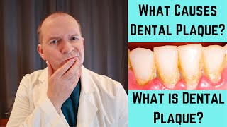 What Causes Dental Plaque What is Dental Plaque [upl. by Ailemaj]