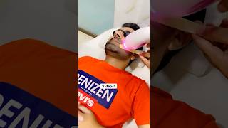 Reality of Skin Laser shortsfeed trending viralvideo skincare skin skinbrightening shorts [upl. by Enilram]