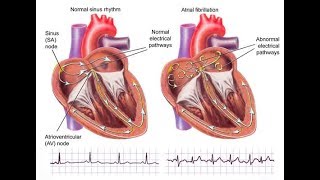 4 things I do to help my afib  magnesium B12 Dr Gupta logbook [upl. by Wilt654]