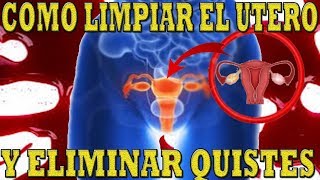 Como limpiar el útero y eliminar los quistes Naturalmente [upl. by Trevorr]