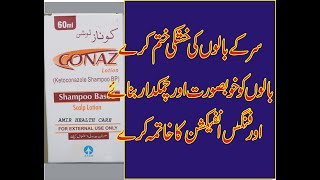 CONAZKETOCONAZOLESHAMPOO BASED LOTION USED FOR DENDRUF SEBORIC DERMATITIS FUNGAL INFECTION IN URDU [upl. by Kentigerma]