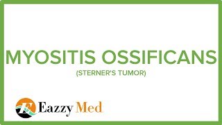 MYOSITIS OSSIFICANS STERNERS TUMOR [upl. by Conlee]