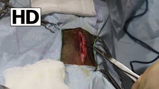 Umbilical Hernia Repair on a 10 Month Old Puppy [upl. by Nance155]