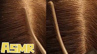 🎧ASMR｜ Scalp itchy See how this girl does it [upl. by Ymirej]