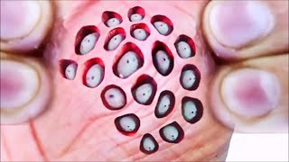 Worlds Greatest Trypophobia Images Fear of Irregular Holes [upl. by Emiatej]