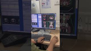 3D reconstruction ct Urography ctscan ctscantechnician trendingshorts tyshorts shortvideo [upl. by Hokanson]