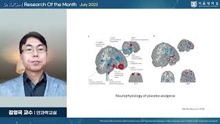 SNU MEDICINE 이달의 연구 2023년 7월 안과학교실 김영국 교수님녹내장 안약의 위약 효과를 네트워크 메타분석으로 탐색한 연구 [upl. by Adnima270]