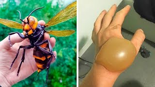 TOP 10 INSECTOS MÁS PELIGROSOS DEL MUNDO [upl. by Killigrew]