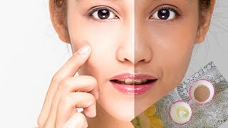 skin Tightning herbal face pack remove pigmentation how to make skin tightning at home [upl. by Boycie]