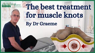 The best way to treat your muscle knots [upl. by Labotsirc]