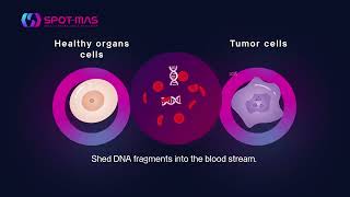 SPOTMAS a MultiCancer Early Detection Test [upl. by Euqinobe240]