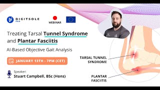 Webinar  AIBased Objective Gait Analysis Treating Tarsal Tunnel Syndrome and Plantar Fasciitis [upl. by Solley]