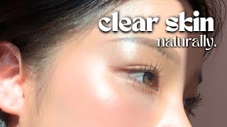 How I Cleared My Skin In 8 Weeks naturally [upl. by Cavanaugh679]