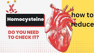 HOMOCYSTEINE WHEN TO CHECK IT  HOW TO REDUCE HOMOCYSTEINE LEVELS  HOMOCYSTEINE BLOOD TEST [upl. by Sumahs694]