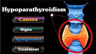 Hypoparathyroidism  Causes  Symptoms  Diagnosis  Treatment ll in Hindi endocrinesystem [upl. by Castle]