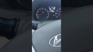 Diagnosing a stall condition 2013 hyundai elantra [upl. by Aitekram]