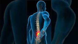 કમરના મણકાની તકલીફ Lumbar Spondylosis and Lumbar IV Disc Herniation માં મળેલ પરિણામ [upl. by Kcerb]