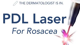 VBeam amp PDL Lasers for Rosacea  Dermatologist Explains [upl. by Raimund]