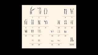 Karyotype notations [upl. by Arihsak]