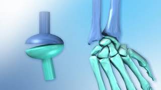 Condyloid Joint animation [upl. by Uolymme]