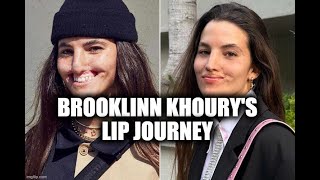 Brooklinn Khourys Lip Journey [upl. by Yliab712]