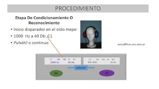 Tecnica procedimental audiométrica básica [upl. by Ammon]