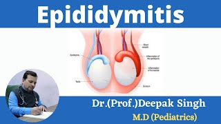 Epididymitis  Inflammation in epididymis  Deepak PD Singh [upl. by Cthrine]