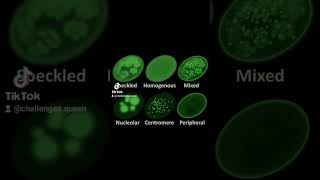 ANA Anti Nuclear Antibody [upl. by Zzahc]