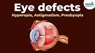 Eye defects  Hyperopia Astigmatism Presbyopia  Dont Memorise [upl. by Leahcin]