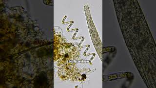 Protozoário gigante passa por dentro de microalga espiralada microorganismos microbiologia [upl. by Kuehn]