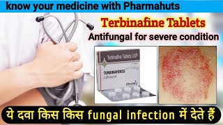 Terbinaforce tablets  Terbinafine tablets ip 250 mg  terbinafine tablets ip 250 mg uses in hindi [upl. by Lokcin]