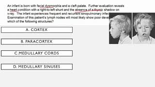 Immunodeficiency Syndromes USMLE Questions [upl. by Ntsyrk]