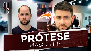 Prótese capilar Masculina [upl. by Anatollo103]