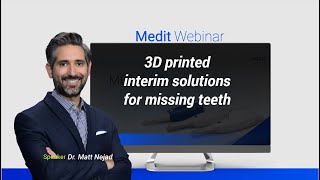 3D printed interim solutions for missing teeth [upl. by Asyla589]