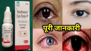 Moxifloxacin eye drops Moxibow eye drops price side effects uses Aankh ka best drops [upl. by Parker]