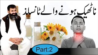 Tonsils Causes amp treatment of Tonsils Infection Homeopathic DRMMUNAWAR DAWOOD [upl. by Heng160]